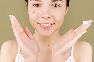 usuwanie przebarwien